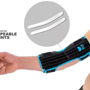 Νάρθηκας ωλένιας νευρίτιδας