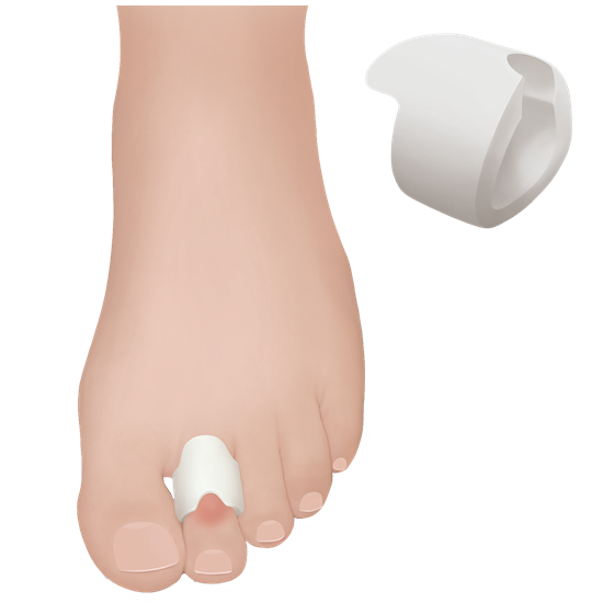 Προστατευτικός δακτύλιος gel