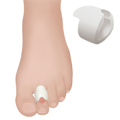 PROTECTIVE GEL TOE RING  